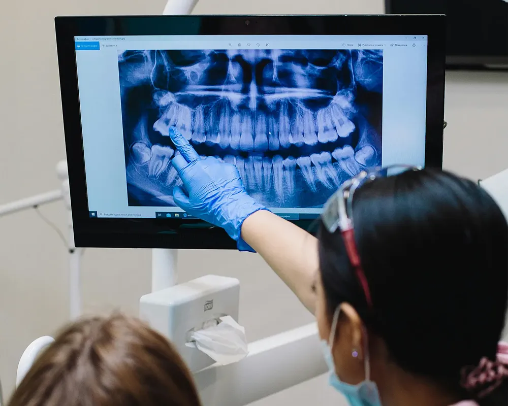 dental xrays